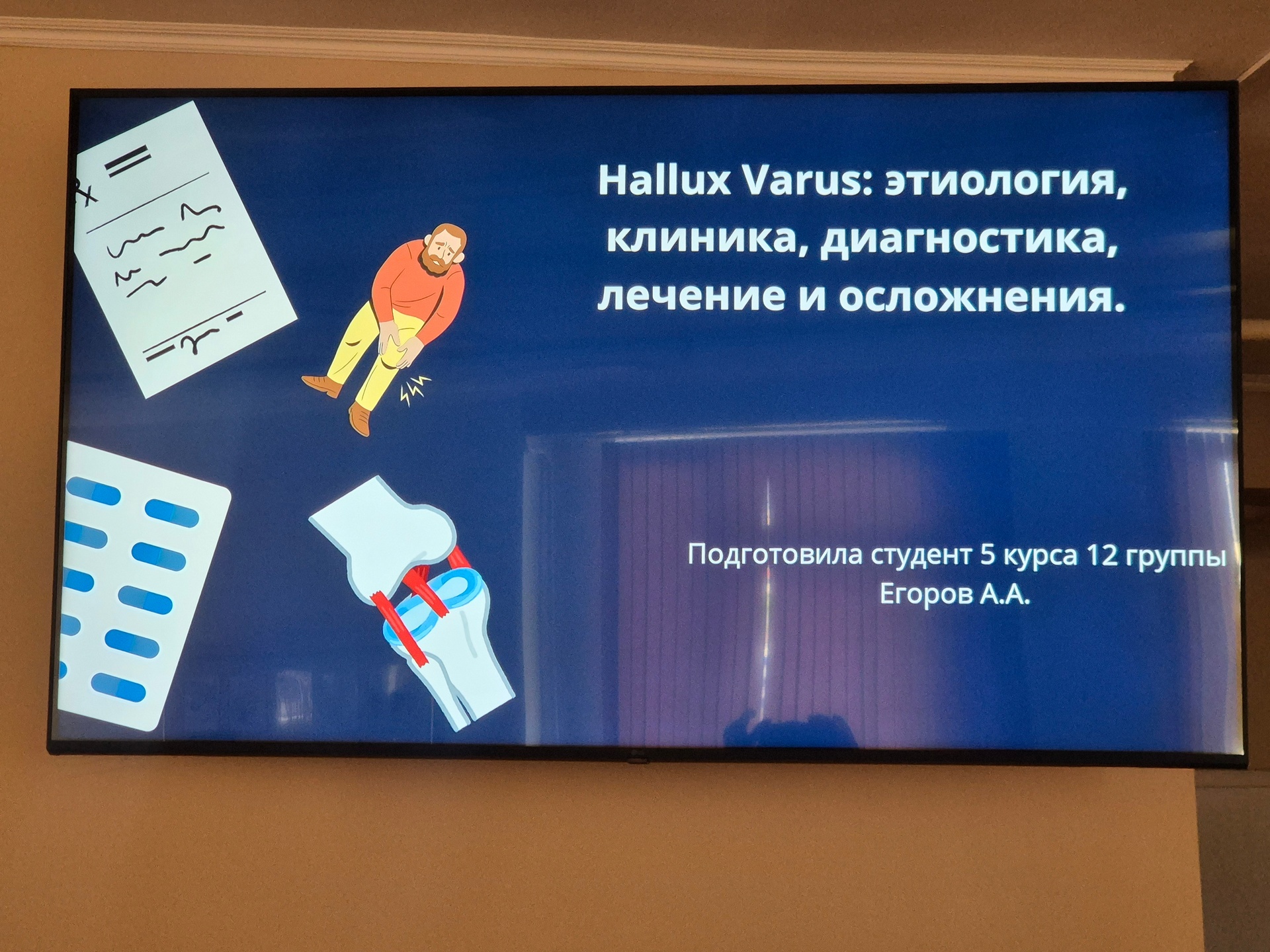 На кафедре травматологии, ортопедии и ВПХ прошло заседание студенческого научного кружка, посвящённое хирургии стопы